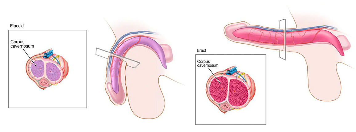 Erectile Dysfunction